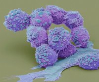 Steve-Gschmeissner-Brain-Cancer-Cells[1].jpg