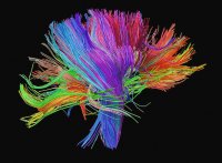 Alfred-Pasieka-White-Matter-Fibres-of-the-Human-Brain[1].jpg